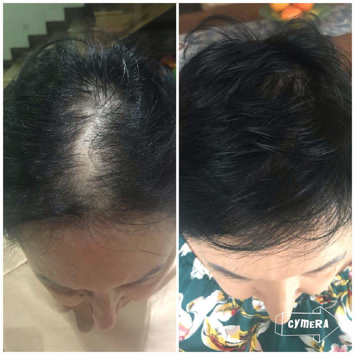Alopecia Treatments Charlene Hogan Skin